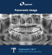 FinScan F350 CBCT Unit