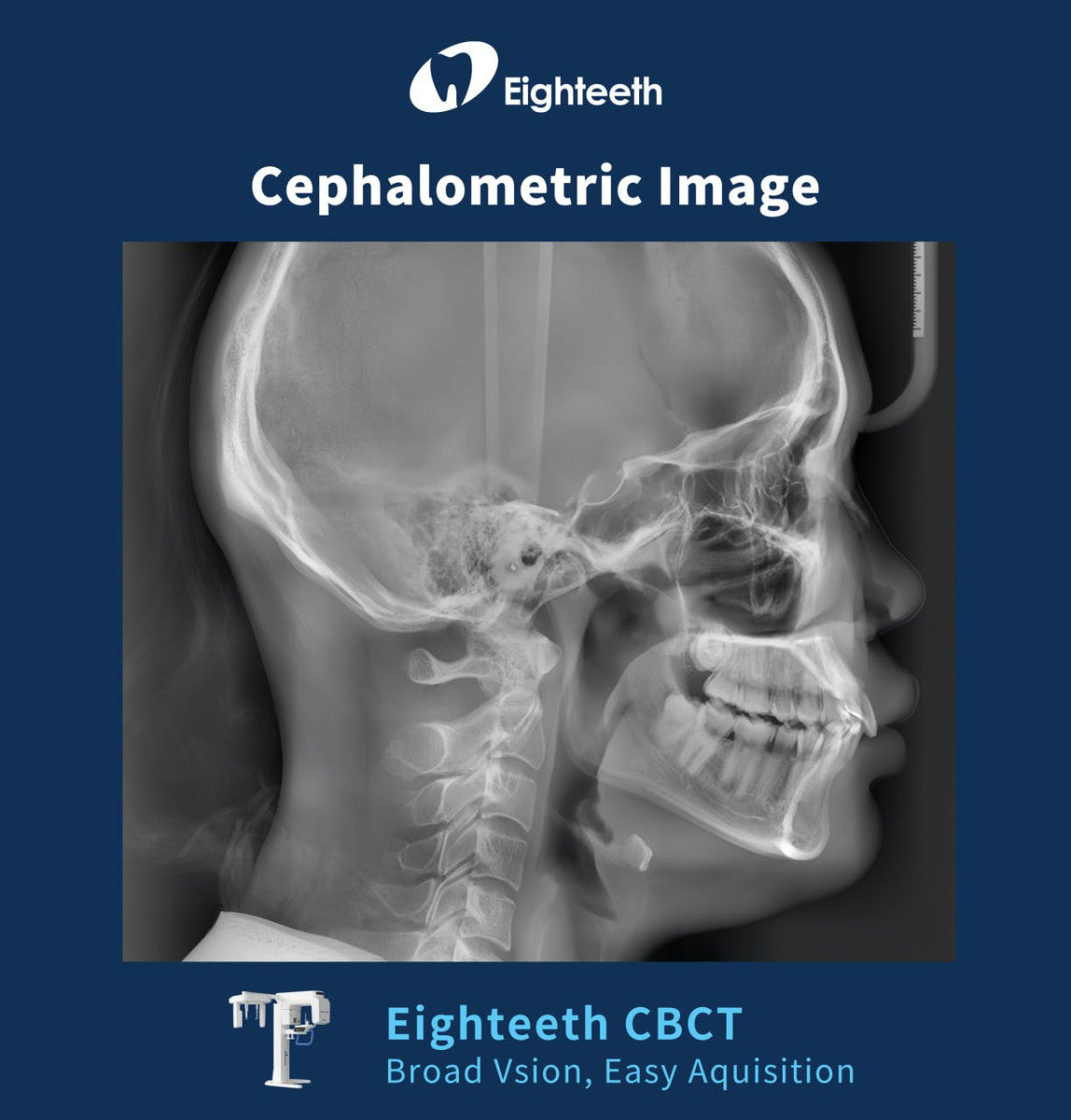 FinScan F350 CBCT Unit