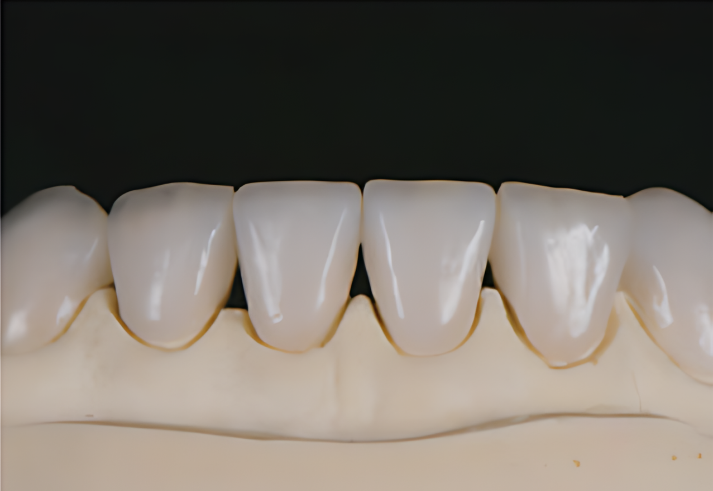 Cameo - Dental Glass Ceramic -400Mpa