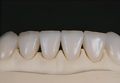 Cameo - Dental Glass Ceramic -400Mpa