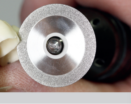 Flexible Diamond Discs 914
