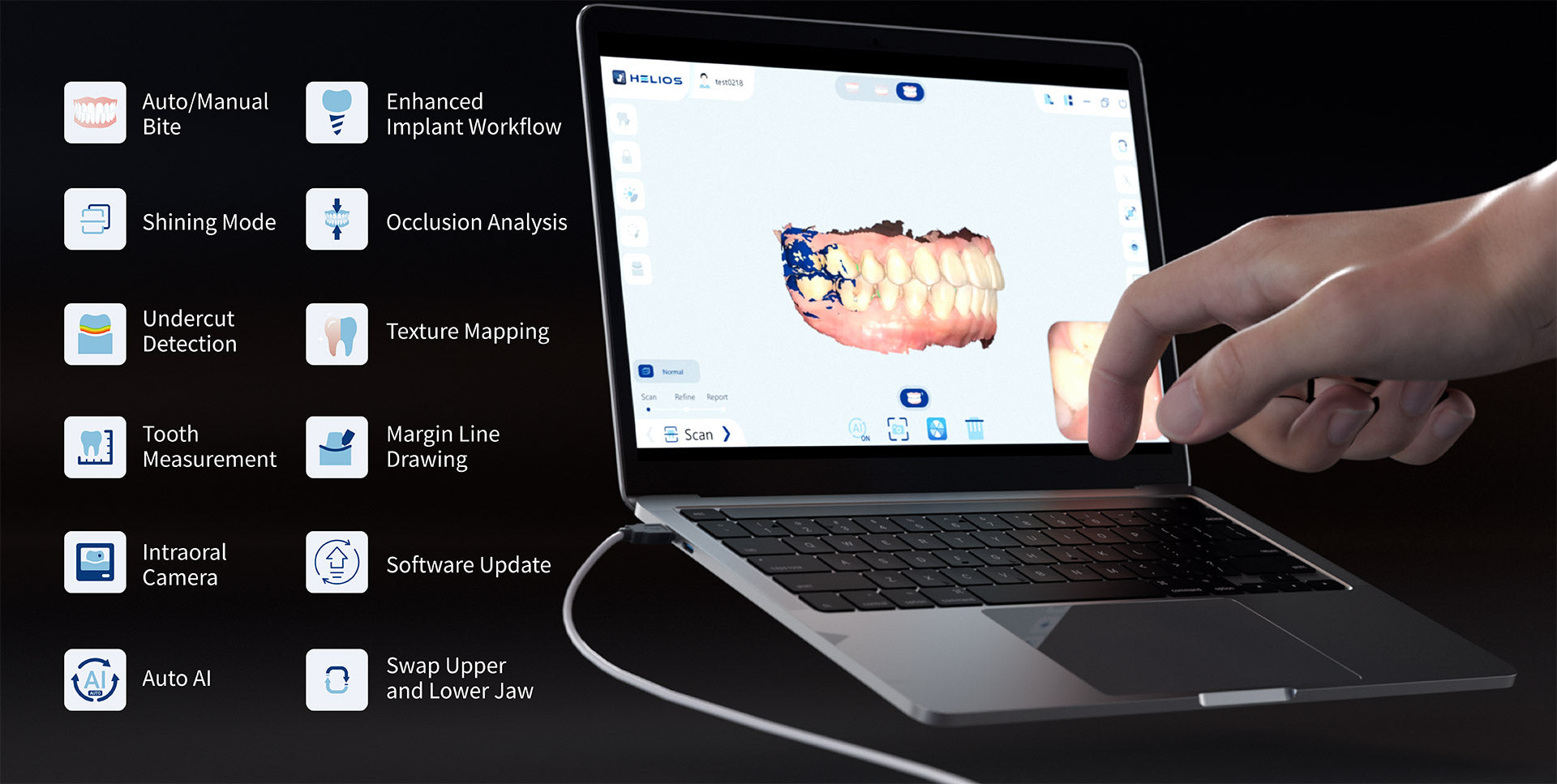 Helios 680 - Intraoral Scanner Wired