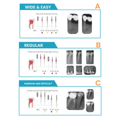 Style Italiano Endodontics Selection F One (Assorted- 5pcs)