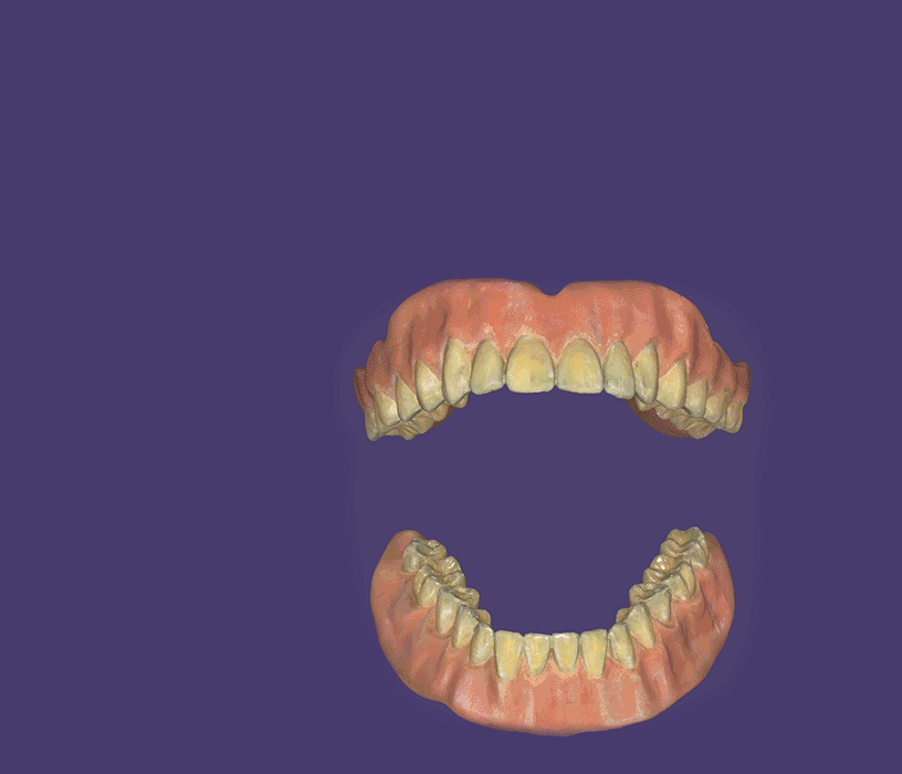 DentalCAD